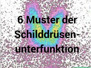 Muster der Schilddrüsenunterfunktion Muster der Schilddrüsenunterfunktion