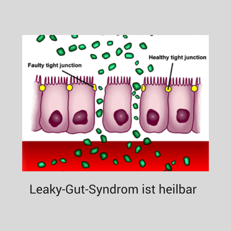 Diät für Candida im undichten Darm Diät für Candida im undichten Darm