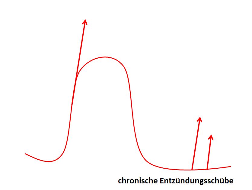 Entzuendung Hashimoto2 Entzuendung Hashimoto2